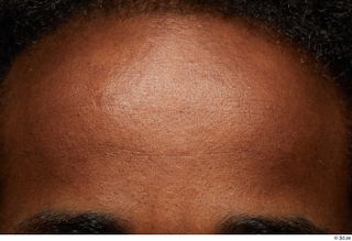 HD Face Skin Canaan-Allvince Epps eyebrow face forehead skin pores…